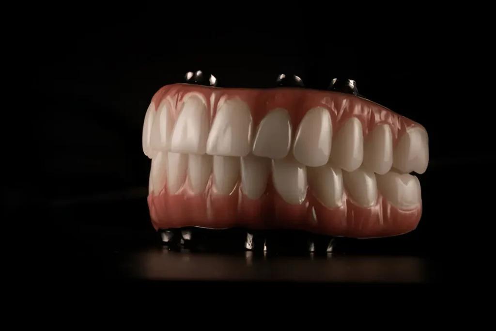 Prótese dentária completa